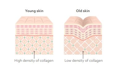 Skin density
